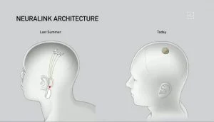Neuralink