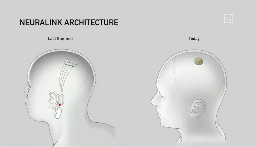 Neuralink