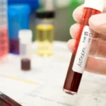 Огнище на антракс в Черногор - БАБХ запечата два обекта за месо