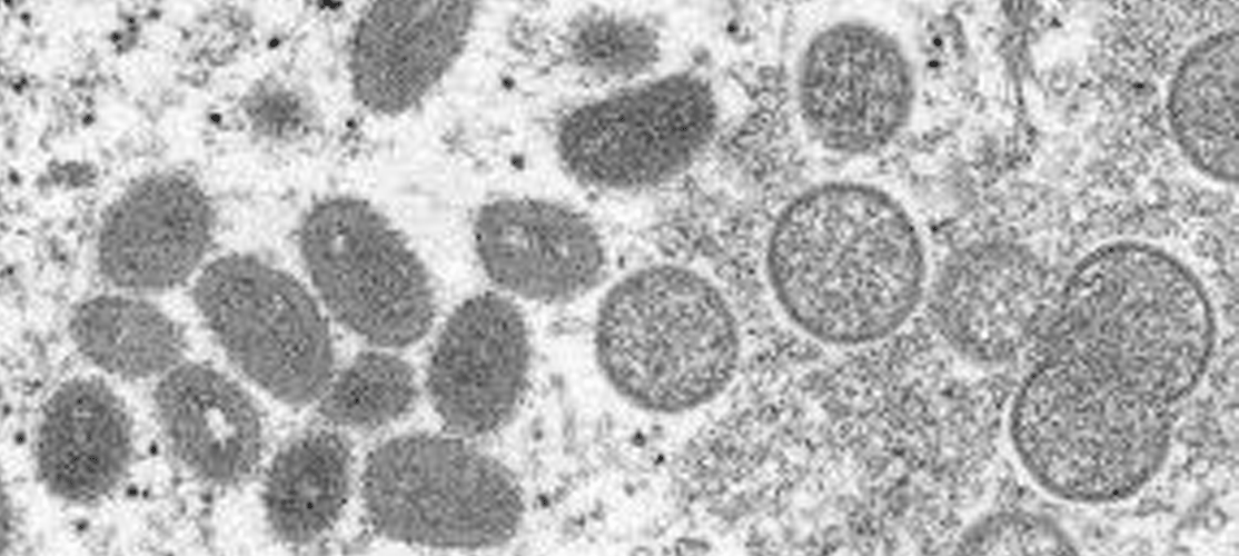 маймунска шарка