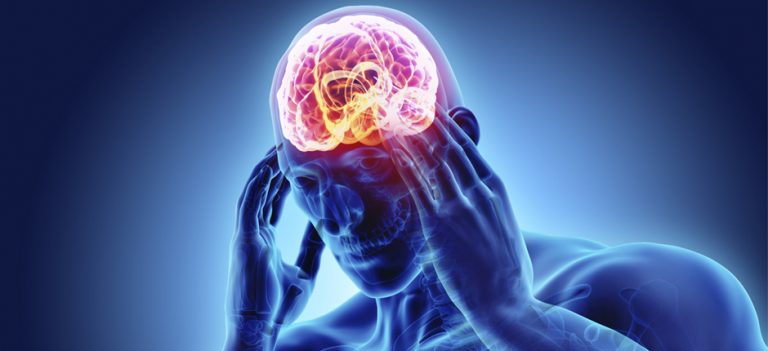 лудост