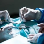 Начало 20 тестис операция